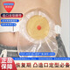 邦德美造口袋腰帶專用肛腸造簍術(shù)后造口腹帶收腹帶二件式底盤防移位腰帶 造口腰帶套裝(卡環(huán)+腰帶)*1套 均碼不挑身形