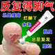 腳氣藥膏止癢脫皮爛腳丫真菌感染專用藥正品治腳氣腳臭的藥香港腳皮膚用藥克霉唑乳膏去看腳縫根癢得治 一盒裝