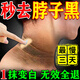 千紹方脖子黑色素沉淀去除治黑棘皮癥藥膏男女胖胳膊肘腋下去黑色素神器 單瓶裝【脖子黑色素去除】