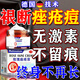 祛痘消i炎痤瘡專用青少年去青春痘粉刺硬疙瘩玫瑰修復(fù)祛痘印藥膏 特效一盒裝【德國技術(shù)】一抹祛痘