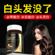 Ocnakoc【專攻白發(fā)】進(jìn)口黑發(fā)膠囊酪氨酸白發(fā)根源轉(zhuǎn)黑刺梨防脫烏發(fā)生物素 4瓶周期裝（根源煥黑，買3送1）