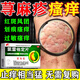 氯雷他定片正品蕁麻疹皮膚過(guò)敏藥蕁麻疹專(zhuān)用藥過(guò)敏止癢斷藥根增強發(fā)貨免疫力皮膚瘙癢抗過(guò)敏藥【視覺(jué)特效】 10mg*5片 2盒裝【風(fēng)團疙瘩 一熱就癢】