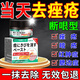 東田祛痘消炎痤瘡專用學(xué)生青少年藥膏硬疙瘩粉刺青春痘印修復(fù)淡化中藥 1盒裝【一抹消痘】特效膏
