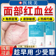 醫續美醫用去紅血絲修復角質(zhì)層薄敏感肌面膜臉部過(guò)敏泛紅屏障受損增厚HW 【買(mǎi)二送一】三盒周期裝大部分用戶(hù)選擇【店長(cháng)推薦】
