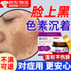 臉部排毒排黑色素去臉上黑斑點(diǎn)沉淀祛除面部痘印美容院專用膏醫(yī)用 臉上去黑色素暗沉淀排毒專用非藥