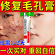 阿達(dá)帕林凝膠醫(yī)用收縮毛孔粗大修復(fù)細(xì)致祛痘印修復(fù)淡化痘印痘坑修復(fù)藥膏祛痘消炎痤瘡?？破つw用藥祛痘印黑頭 1盒【治療痤瘡建議三盒裝】