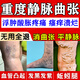 [威仕]傷濕止痛膏 6cm*10cm*8貼 1盒裝 靜脈曲張專用藥膏藥貼特新效期血管堵塞疏通藥蚯蚓腿血管凸起酸麻腫脹疼痛 多盒效果好