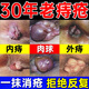 北京同仁堂痔瘡膏去肉球斷根止癢肛門(mén)瘙癢醫用凝膠官方正品直腸脫肛回縮專(zhuān)用 100%特效發(fā)貨【痔瘡專(zhuān)用】單盒 內外混合速止血止痛消腫脫肉球卡波姆