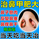 鼻甲肥大專用藥根藥治鼻炎特貼效藥鼻甲肥大鼻塞神器過敏性鼻竇炎鼻子癢流涕打噴嚏耳鼻喉用藥鹽酸西替利嗪片 1盒【鼻甲肥大專用藥】