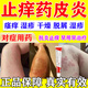 止癢抑菌皮膚瘙癢身體癢止癢濕疹止癢去專根999皮炎平皮膚瘙癢皮炎復方醋酸地塞米松乳膏 1支【皮膚瘙癢】國藥OTC