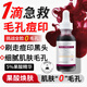 施丹雅果酸精華液溫和保濕刷走泛紅痘印毛孔粗大閉口粉刺黑頭角質(zhì)30ml