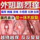 達(dá)克寧婦科用藥 非處方藥外陰瘙癢陰道炎婦科炎癥專用藥私處瘙癢止癢殺菌藥膏皮膚用藥達(dá)克寧硝酸咪康唑乳膏 1盒【女性私處瘙癢專用】真菌感染 達(dá)克寧婦科用藥 非處方藥-陰道炎婦科炎癥用藥