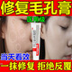 收縮毛孔粗大修復細致醫(yī)用阿達帕林凝膠改善毛孔粗大醫(yī)用去黑頭祛痘消炎痤瘡專用青少年藥膏修復痘坑痘印 1盒【毛孔粗大藥膏】醫(yī)用級 藥房直發(fā)