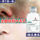 同仁堂收縮毛孔精華液去黑頭修復(fù)收縮毛孔粗大修復(fù)細(xì)致男女士學(xué)生3瓶