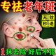 碧素堂祛斑霜美白淡化老年黃褐雀斑去斑去黑色素男士老年斑臉部手背祛斑 強(qiáng)效特效:買二送-【快速淡斑】 專用霜去老人斑淡化淡斑醫(yī)用正品