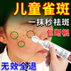 兒童祛斑膏小孩專用臉部長雀斑遺傳去除煙酰胺醫(yī)用凝膠淡化黑色素 正品一盒祛斑霜青少年男女臉上用