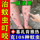 埃姆登制藥兒童蚊蟲叮咬止癢消腫藥膏神器嬰幼兒專用基孔肯雅熱驅蚊防蚊預防 一盒裝