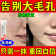 阿達(dá)帕林凝膠改善毛孔粗大去黑頭醫(yī)用祛痘消炎痤瘡專用青少年收縮毛孔粗大修復(fù)細(xì)致醫(yī)用膿包黑頭藥膏皮膚用藥 1盒【收縮毛孔專用藥】