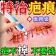 去疤痕修復(fù)凝膠醫(yī)院專用祛疤膏手術(shù)縫針增生凸起除疙瘩淡化黑色素 1盒【祛疤痕專用修復(fù)】多買多送部分地區(qū)次日達(dá) 芭痕克星醫(yī)用硅酮去除巴痕修復(fù)凝膠愈合傷口