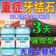 坂枝野尋牙結(jié)石清理神器去口臭去黃牙垢結(jié)石清除強(qiáng)力溶解口腔牙結(jié)石漱口水 【強(qiáng)力溶解口腔異物】一瓶 強(qiáng)力溶解口腔異物牙結(jié)石清理神器