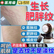 大腿妊娠生長(cháng)紋淡的化皮膚斷裂皮膚松弛肥胖紋修復霜士?jì)榷亲幽信?修復各種紋痕【1盒裝/70g】加量 肥胖紋修復男女士肥胖紋祛除神器