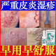 南京同仁堂止癢抑菌皮膚瘙癢身體癢止癢皮炎濕疹真菌感染大腿內(nèi)側(cè)皮蘚專用 3瓶周期裝【立省59】