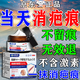 秋雅奈緒去疤痕藥膏專(zhuān)用修復新舊疤痕手術(shù)縫針增生凸起軟化疤痕去腐i生肌 一盒裝【醫院同款】
