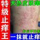 皮膚止癢特藥止癢抑菌皮膚瘙癢身體癢蚊蟲(chóng)叮咬痱子皮炎濕疹真菌感效特級止癢王皮膚用藥復方倍氯米松樟腦乳膏 3盒【嚴重瘙癢 癢的抓出血還癢 】越嚴重越管用