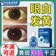 藤石制藥眼白發(fā)黃眼睛清澈去黃可搭眼藥水專(zhuān)用黃斑病變水腫眼睛渾濁干澀HW 【單盒裝】眼白發(fā)黃專(zhuān)用