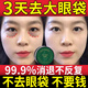 仙宸眼袋霜去眼袋消除重度眼袋貼專用嚴(yán)重中老年男士女士眼袋去除神器 1盒裝【一貼消除】