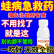 蛙病消牛蛙專(zhuān)用藥水產(chǎn)養殖青蛙治歪頭白眼紅腿腐皮爛身腸炎蛙益z 3瓶【病害全消】200ml/瓶保護液