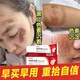 臉上黑色素沉淀臉部排毒排黑色素黑斑點(diǎn)面部黑點(diǎn)皮膚色素沉著(zhù)暗沉痘印曬斑淡斑美白熊果苷軟膏 一盒體驗裝