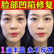 臉部凹陷填充液膠原蛋白太陽(yáng)穴眼窩淚溝凹陷填充神器面部修復精華 買(mǎi)3送2【5盒裝】不反彈