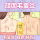 毛囊焱炎沐浴露艾草男女士背后長(cháng)痘痤瘡疙瘩馬拉色菌雞皮膚毛囊堵塞皮炎粉刺膿包抑菌止癢清洗神器 單盒體驗裝