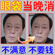 南慈堂去眼袋貼膜淡化細紋祛眼袋消除重度嚴重中老年專用黑眼圈提拉緊致 【單盒裝】 20片 眼袋去除神器