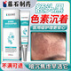 藤石制藥額頭去黑色素沉淀去除淡化臉上面部嘴角黑斑點(diǎn)祛痘印疤痕印去斑DS 2盒裝 第2盒半價(jià) 臉部黑色素消除醫(yī)用藥房同售膏