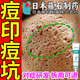 藤石制藥醫(yī)用痘印痘坑修復(fù)凹洞凝膠祛痘印修復(fù)淡化痘印溫和閉口舒緩痘疤HB 送棉簽【買二送一】周期裝大部分用戶選擇