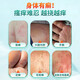 股癬大腿內側真菌感染腹股溝股蘚大腿根瘙癢特專(zhuān)效藥體癬花斑癬銅錢(qián)癬潮濕男士私處發(fā)黑止癢皮膚用藥克霉唑乳 1盒克霉唑乳膏素+1盒鹽酸特比荼芬噴霧劑非處方藥