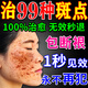 德傳公去斑去黑色素美白祛斑霜淡化老年黃褐雀斑曬斑女士專用醫(yī)用祛斑霜 一盒 強(qiáng)力祛除臉上手部臉部黑斑點(diǎn)