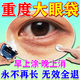 歐誘去眼袋消除重度眼袋專用眼袋霜去大眼袋嚴(yán)重中老年祛男女士貼神器 100%強(qiáng)效去除【一抹消除】1瓶