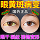 熊膽滴眼液黃斑病變?nèi)~黃素成人京東眼底發(fā)黃色覺異常大藥房眼白去黃干澀癢紅血絲滴眼液 1盒【建議多盒】