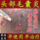 毛囊炎藥膏 頭部專用藥膏后背胳膊面部私處長疙瘩毛囊堵塞發(fā)紅皮膚瘙癢膿包紅腫皮膚用藥 莫匹羅星軟膏 1盒頭上長疙瘩膿包頭皮癢有疙瘩發(fā)紅