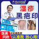 藤石制藥濕疹淡化黑印黑色素沉淀膏專(zhuān)用可搭去疤痕黑斑印修復疤痕BP 買(mǎi)2送1【大面積紅黑疤印】