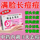排毒養(yǎng)顏祛痘內(nèi)調(diào)內(nèi)分泌失調(diào)去黑色素沉淀內(nèi)調(diào)祛痘中成藥祛痘淡化痘印痤瘡硬疙瘩專用藥祛痘藥內(nèi)服排毒養(yǎng)顏片 1盒【內(nèi)調(diào)祛痘痘印】