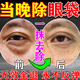 歐誘去眼袋消除重度眼袋專(zhuān)用女男士中老年祛除嚴重大眼袋霜神器貼正品 買(mǎi)5送4【永久消除不反彈】 去眼袋去除神器男士最好的眼霜緊致抗皺淡化細紋黑眼圈