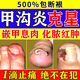 華林堂甲溝炎專用根的治腳趾甲往肉里長去i根消腫止痛去肉芽治嚴重息肉 100%特效一盒