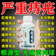 外痔瘡專(zhuān)用藥去肉球痔瘡藥膏去肉球內外混合痔瘡專(zhuān)用藥槐角丸痔瘡口服藥痣痔專(zhuān)用藥去肉球斷肉根正品痔瘡藥 3盒痔瘡藥【劇烈疼痛 拉不成屎】100%正品特效