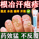 汗皰疹100%特專(zhuān)用效藥濕疹特瘙癢效藥止癢去治根手指上癢起小水泡止癢抑菌膏脫皮真菌感染阿昔洛韋乳膏 1盒【手癢起小水泡止癢專(zhuān)用藥】