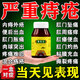 槐角丸痔瘡專用藥痔瘡膏去肉球內(nèi)外混合痔瘡專用藥大便出血拉便血內(nèi)痔外痔混合痔特長(zhǎng)效藥 三盒裝【拉屎帶血 肛門疼痛】巨治 治痔瘡特猛