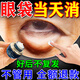 北京同仁堂去眼袋除神器男女士專用消重度除眼袋霜去大眼袋嚴(yán)重中老年專用貼 買2送1【當(dāng)晚消眼袋】多數(shù)顧客已拍